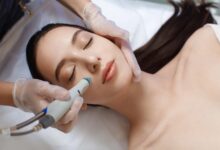 Laser Resurfacing Chicago