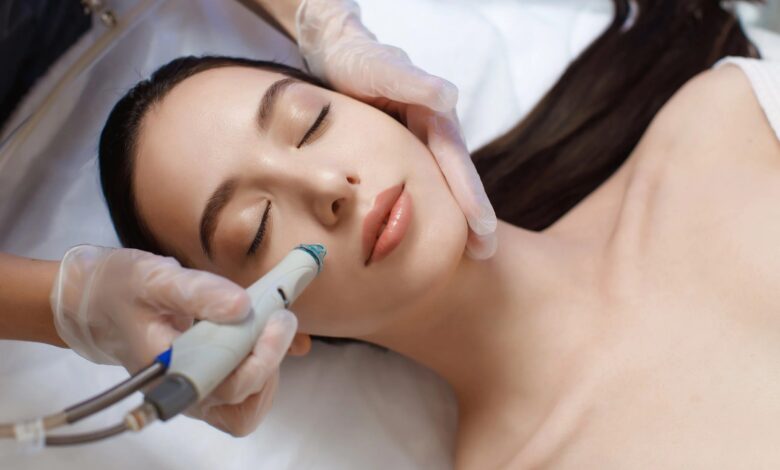 Laser Resurfacing Chicago