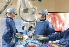 Endoscopic Spine Surgery in Kerala