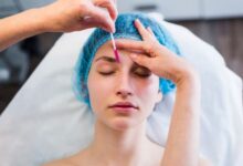 Thread Facelift Treatment in Kolkata
