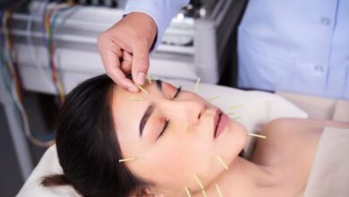 Thread Lift Treatment