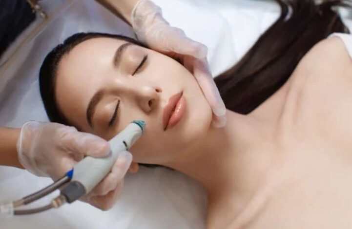 Laser Resurfacing Chicago