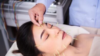 Thread Lift Treatment