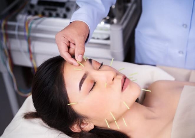 Thread Lift Treatment