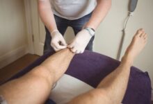 ⁠vericose veins treatment in mumbai